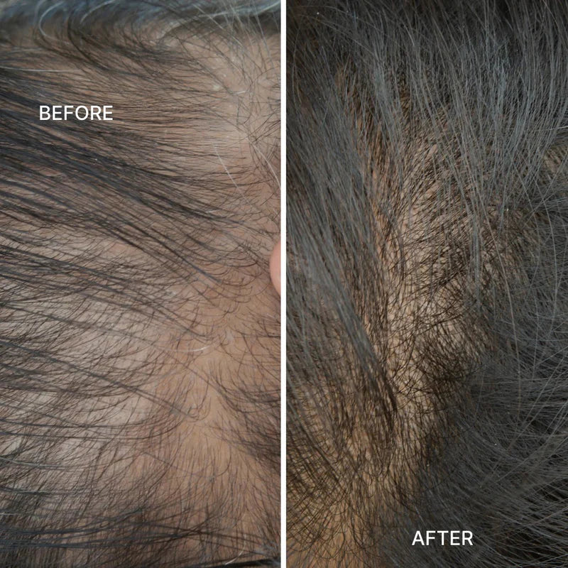 Electric Vibration Massage Comb