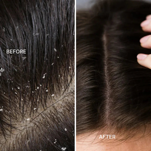 Electric Vibration Massage Comb